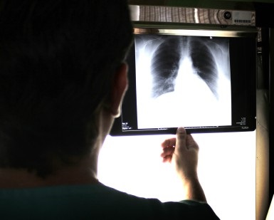 A doctor examines X-rays of a pair of lungs.